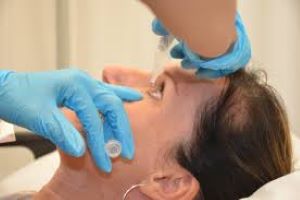 glaucoma treatment