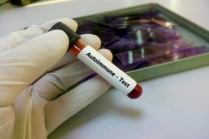 Autoimmune Therapy