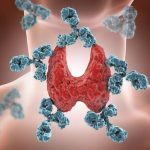 Euthyroid Autoimmune Thyroiditis