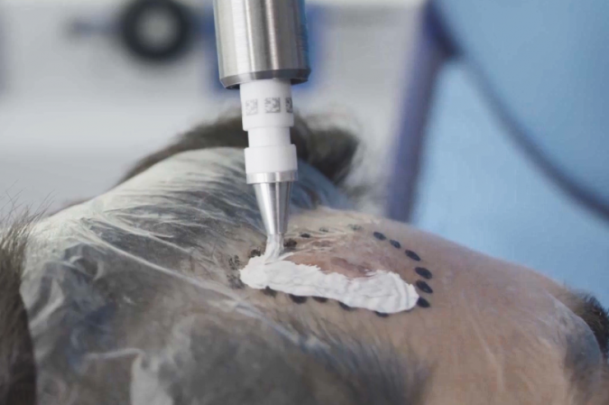 skin cancer treatment