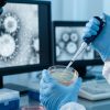 Shamonda virus, first human case in France: the patient has died shamonda virus
